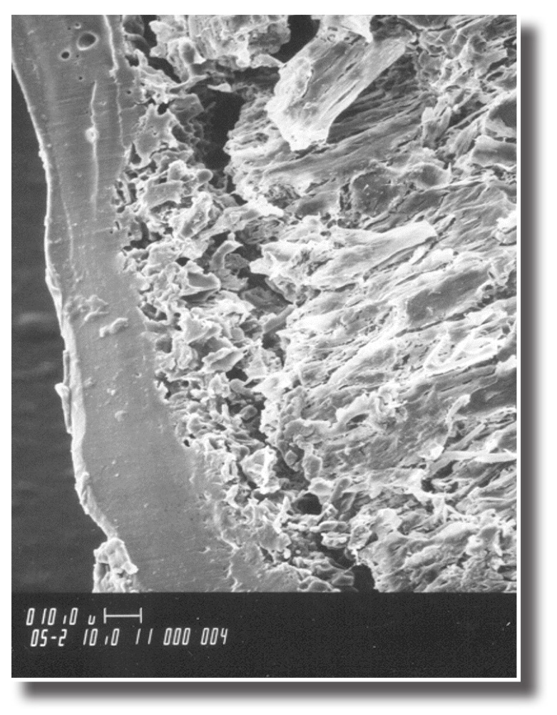 POLYON under a microscope